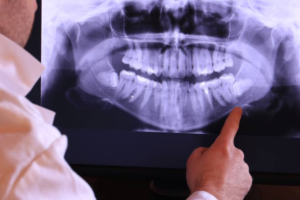 Best Emergency Gum Treatment in Las Quintas Fronterizas, TX