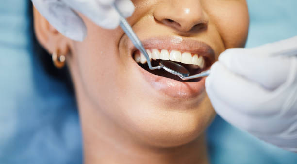 Best Emergency Dental Care for Broken or Chipped Teeth in Las Quintas Fronterizas, TX